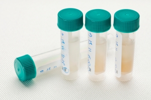 samples of saliva in plastic tubes collected at different time of day for laboratory hormone profile analysis
