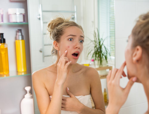Best Acne Treatment: Natural & Top Ways For Healthier Looking Skin.