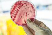 gut bacteria 