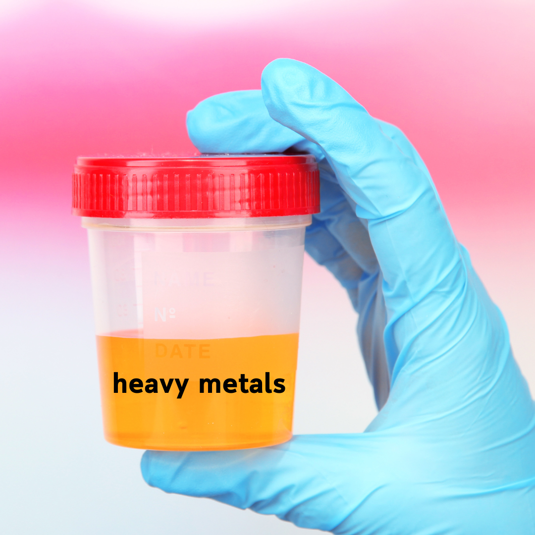 heavy metals test urine